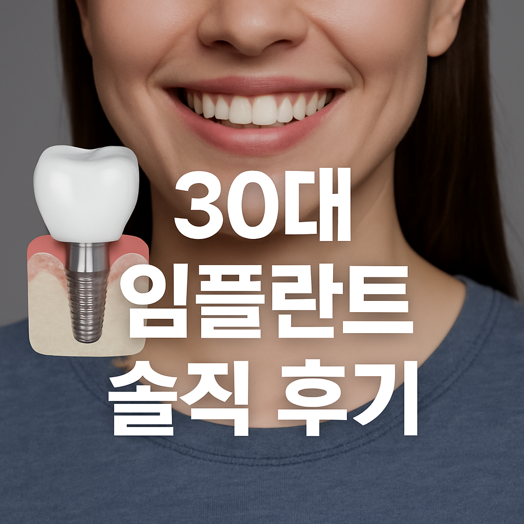30대 임플란트 후기