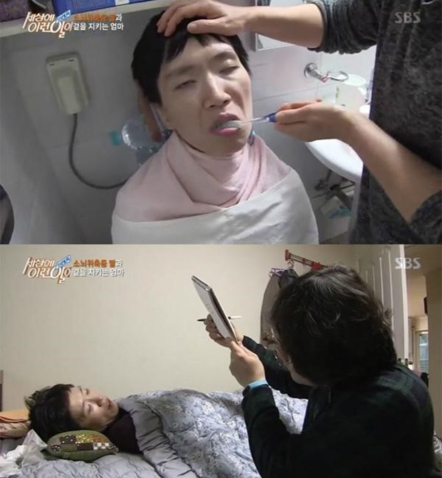  소뇌위축증 증상 치료
