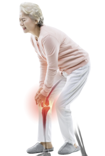 무릎 십자인대 파열 증상