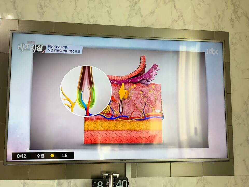 탈모를 예방할 수 있는 방법&amp;#44; 맥주효모