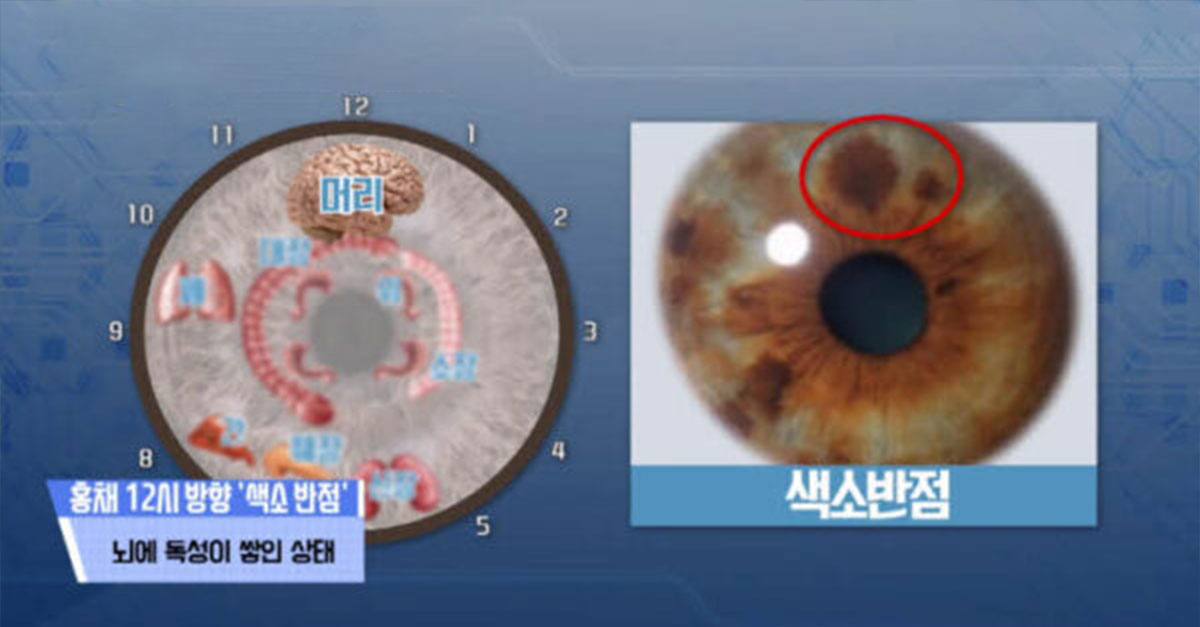  눈동자로 알아볼 수 있는 나의 ‘건강’ 상태