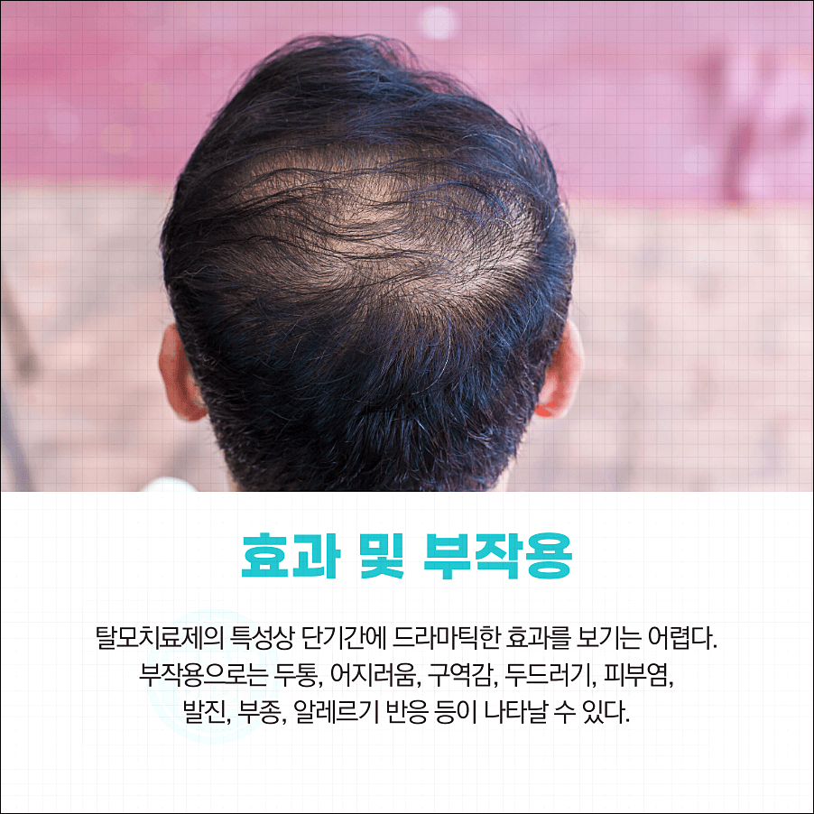 로게인폼 효과 사용법 가격