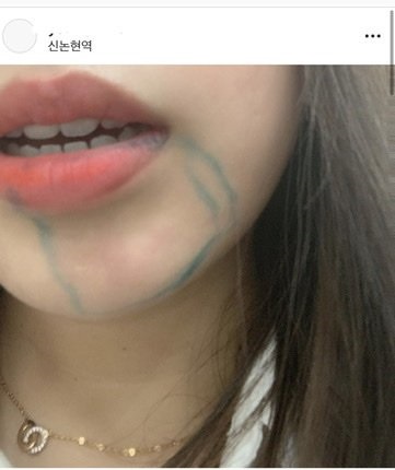 현재 인스타에서 난리난 치과