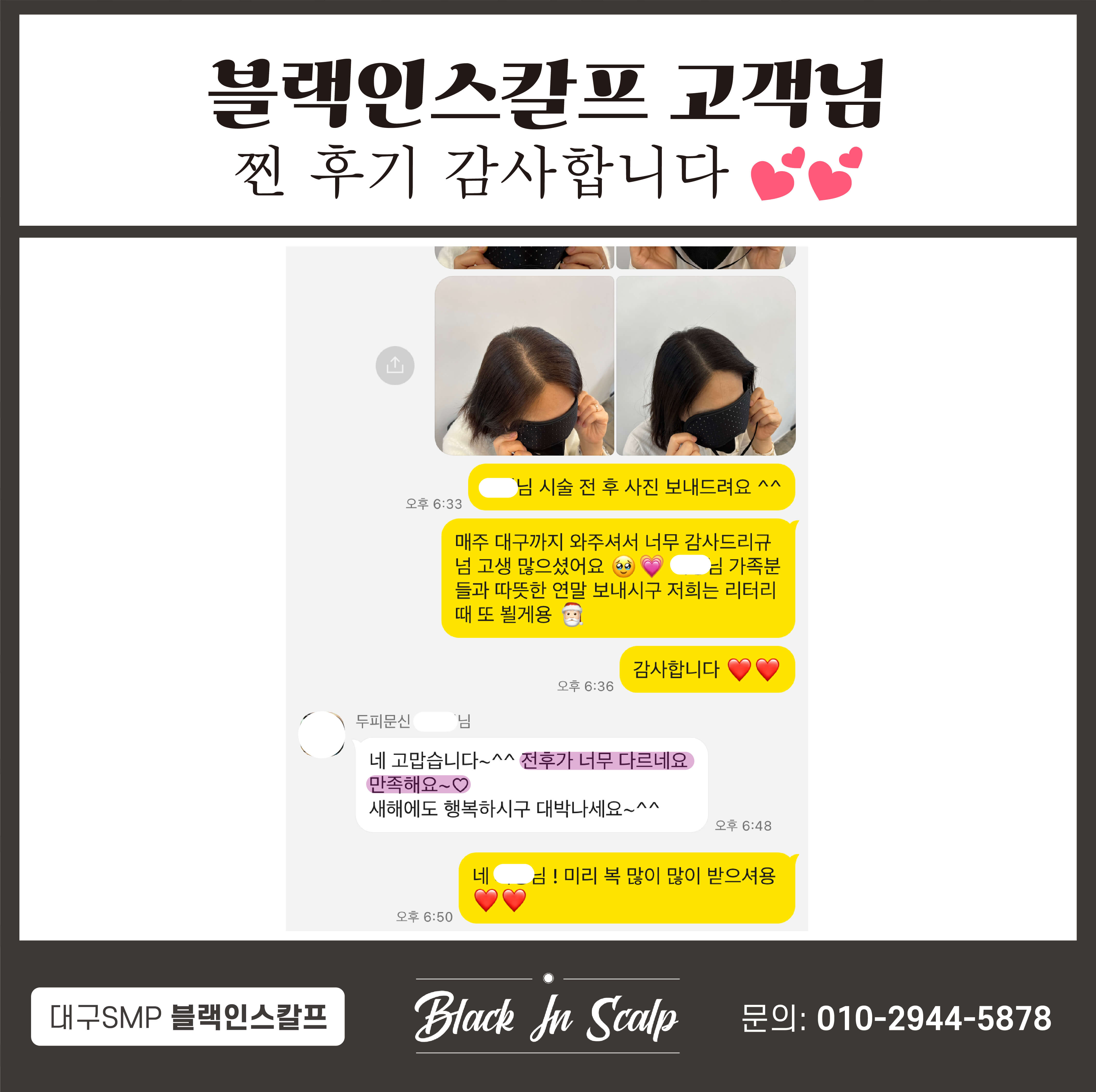 도트인스칼프 이미지