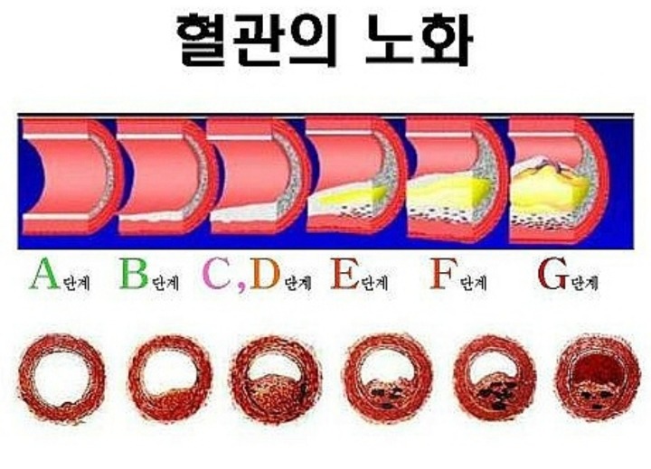  혈관청소에 좋은 음식