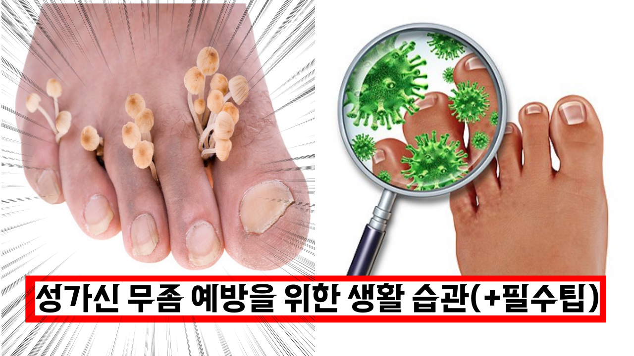  전문가가 말하는 성가신 무좀 예방을 위한 생활 습관(+필수팁)