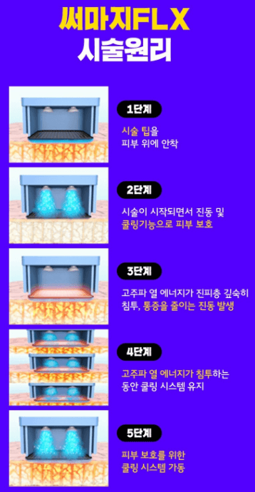 써마지 가격 600샷 효과