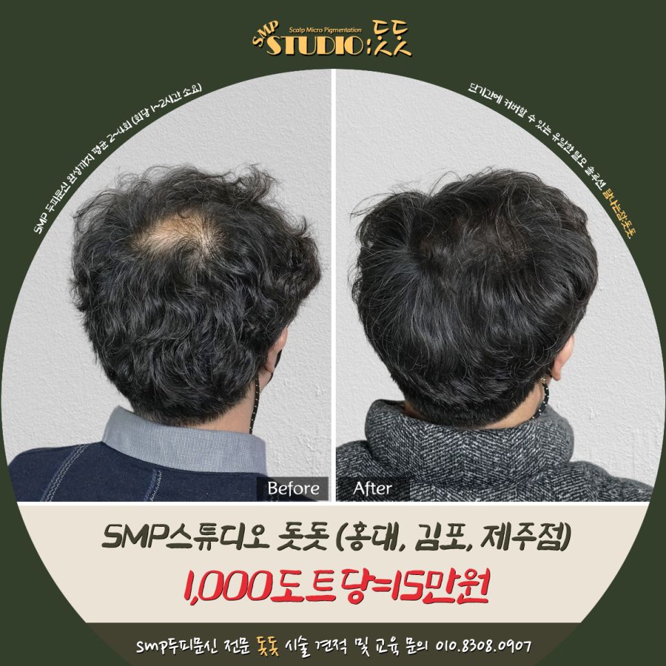  파주 두피문신 3회차로 보는 완성도