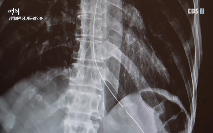 명의 - 건강을 대변하는 대변 2부 장 건강 회복 프로젝트_ 220603.avi_20220604_190009.916.jpg