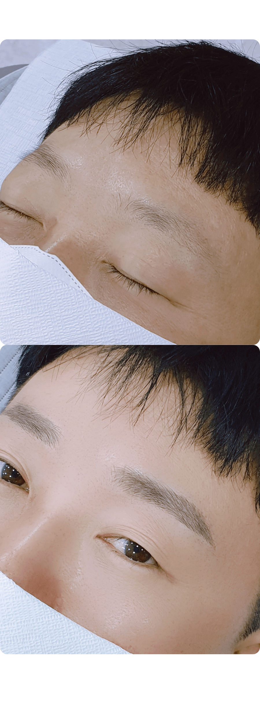 남자눈썹전후