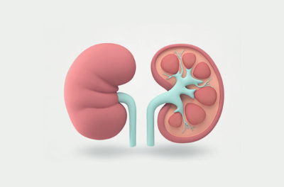 신장 기능이 좋지 않은 증상입니다.