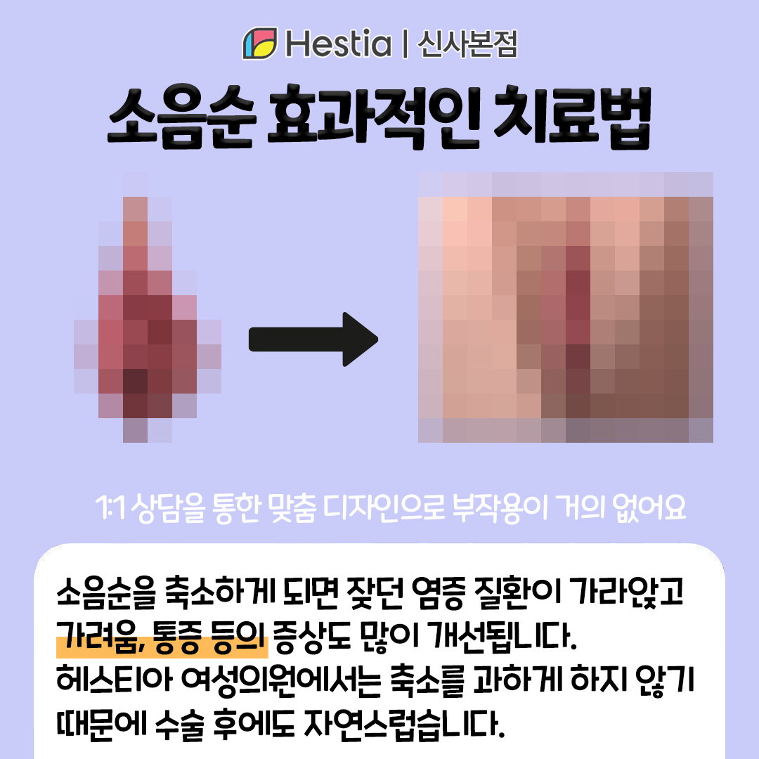 생식기 질환 소음순 비대칭 원인 효과적인 소음순 치료 방법은?