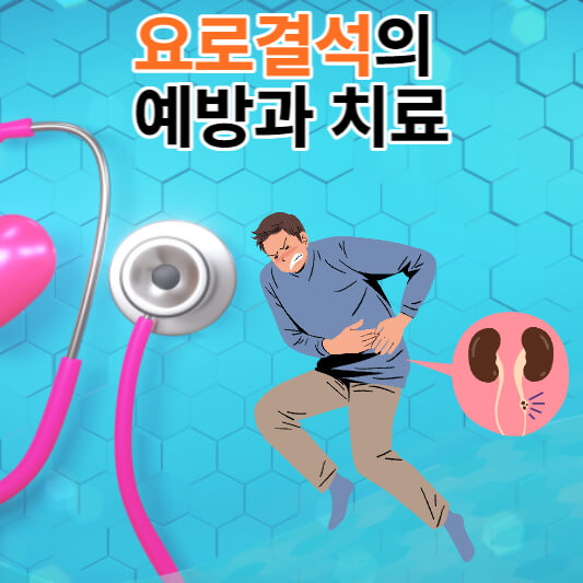 요로결석의 원인과 증상 및 예방과 치료법