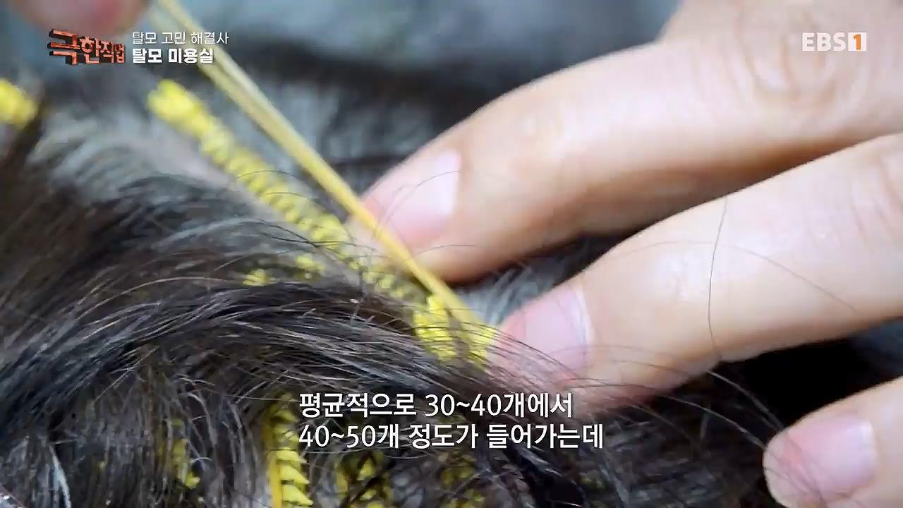 TV - 전 국민의 평생학교 EBS탈모 고민 해결사.mp4_20230508_195811.054.jpg