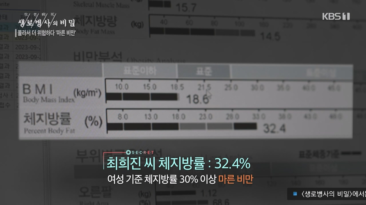 생로병사의 비밀.E889.231109p-NEXT.mp4_20231109_203827.933.jpg