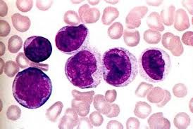 Eosinophil 수치