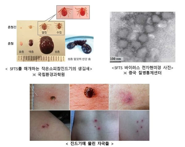 SFTS (중증열성혈소판감소증후군) 증상