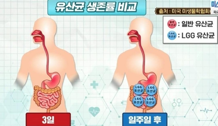 좋은유산균-나쁜유산균