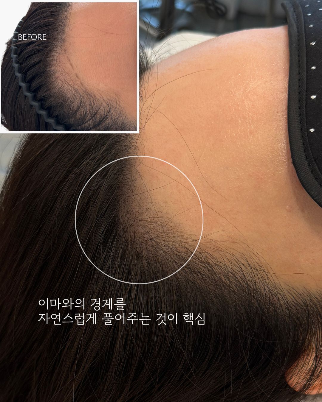 루리헤어 이미지