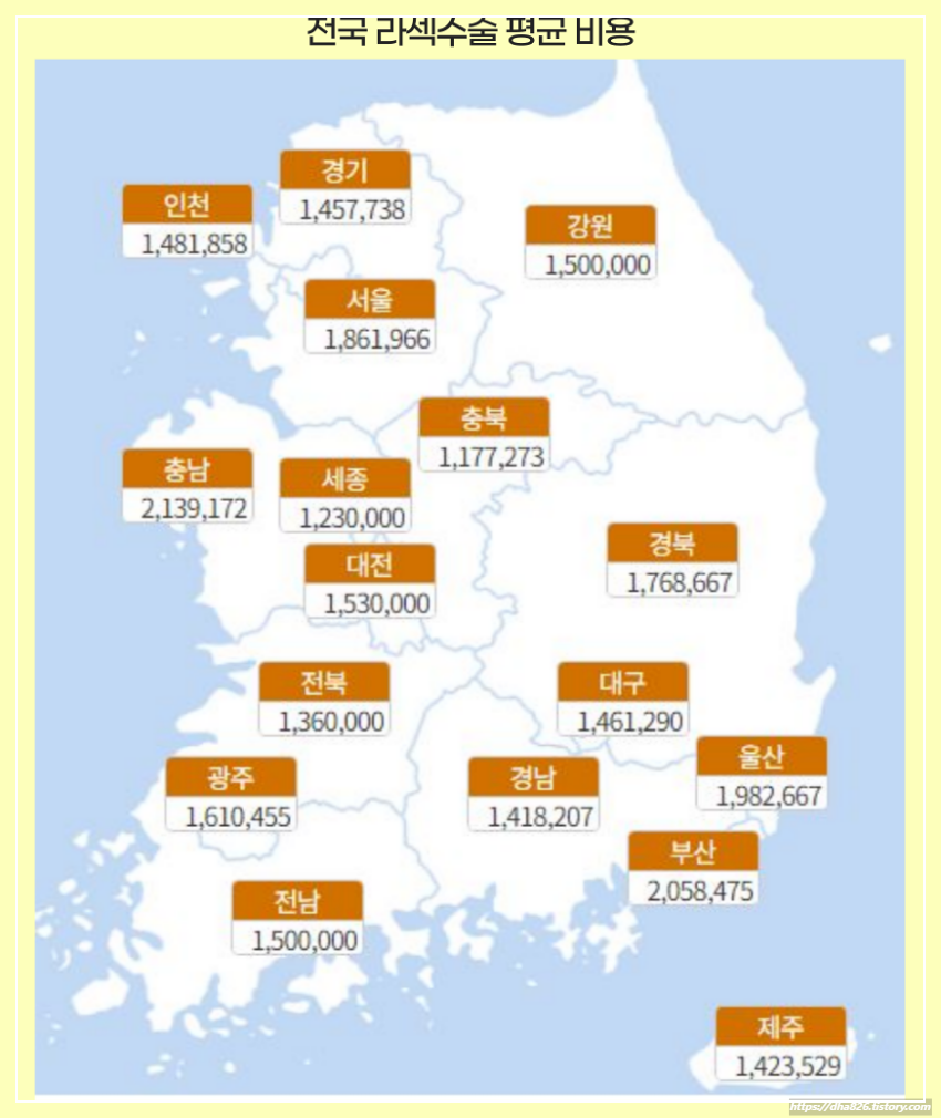 전국 라섹수술 평균비용