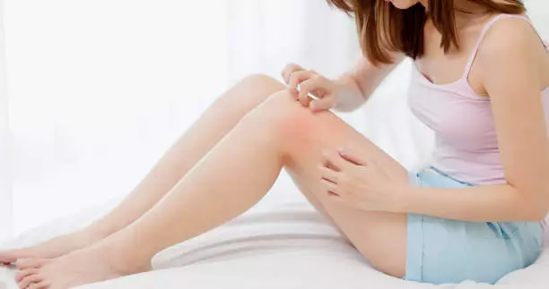 저녁에 피부가려움증의 원인
