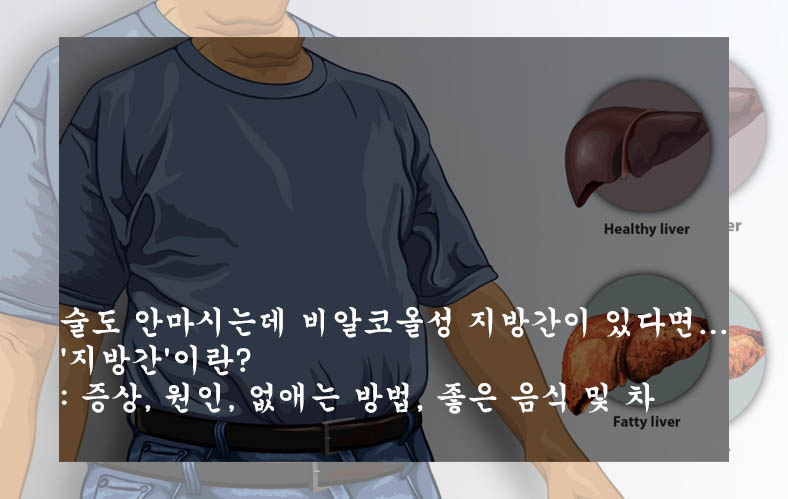  술도 안마시는데 비알코올성 지방간이 있다면...'지방간'이란?: 증상, 원인, 없애는 방법, 좋은 음식 및 차
