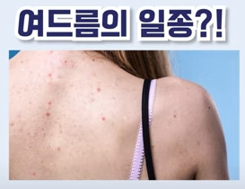  피부과에서 알려주는 뾰루지 여드름 예방법
