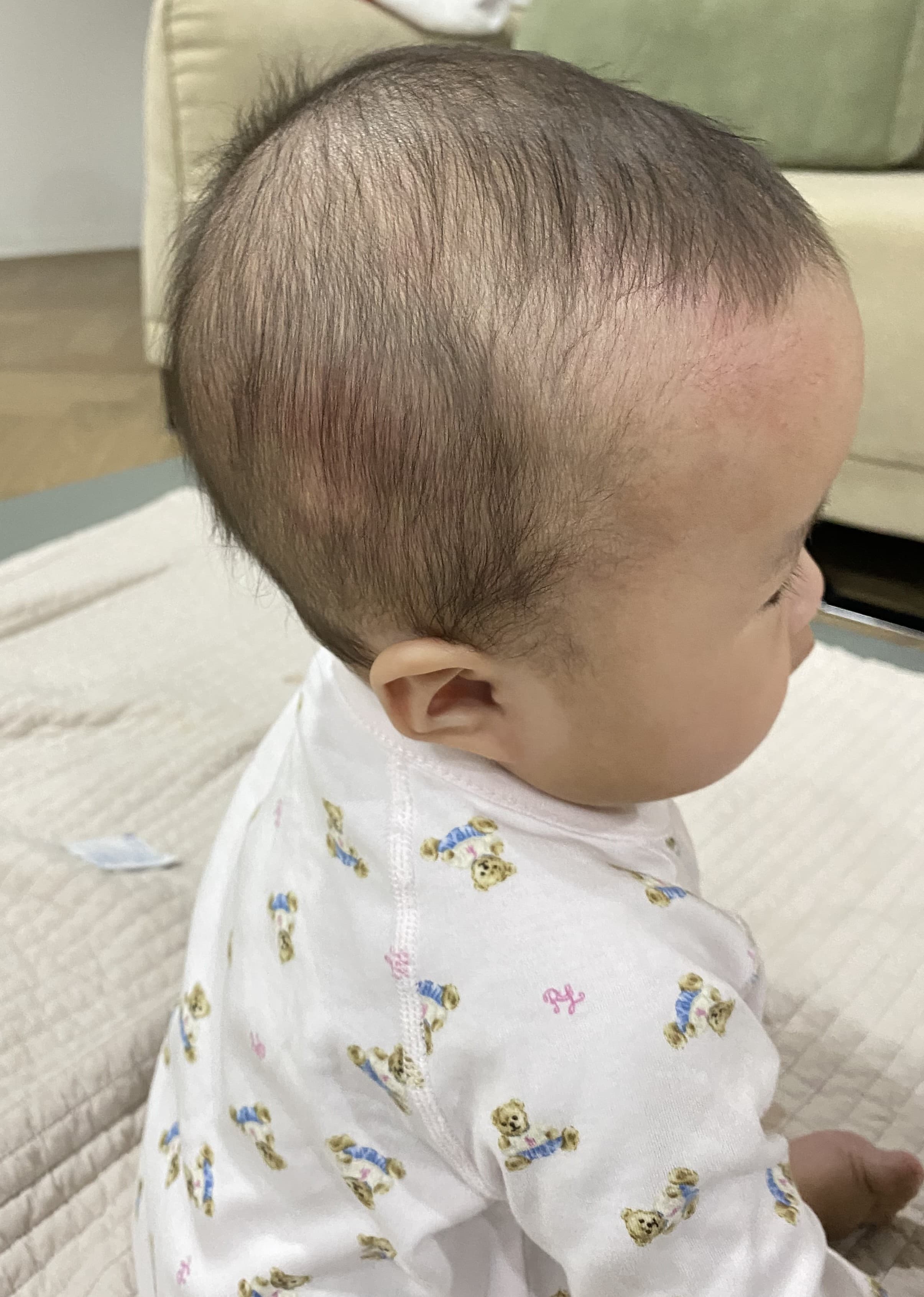 우리아이 두상교정 헬멧