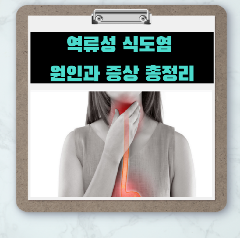  명치를 바늘로 찌르는 고통 - 역류성 식도염 증상