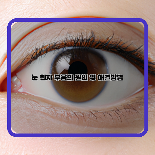  눈 흰자 부음, 효과적인 예방과 해결방법 알아보기