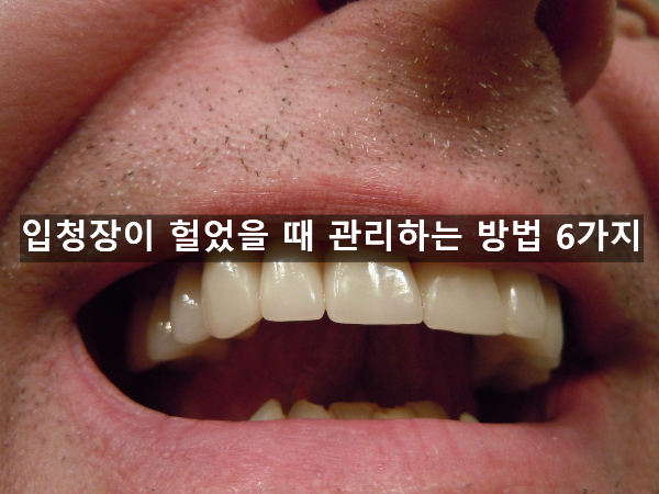  입청장이 헐었을 때 관리하는 방법 6가지