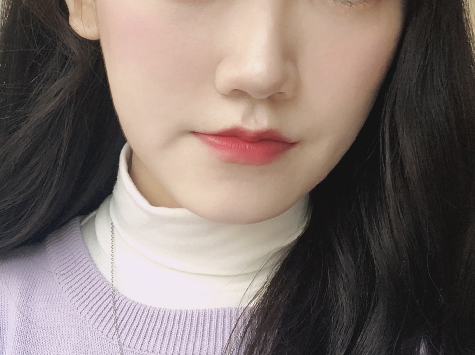 2차 코 봉오리 축소 코 조각 주사 후기교대역피부과 1개월 반 지났어 11