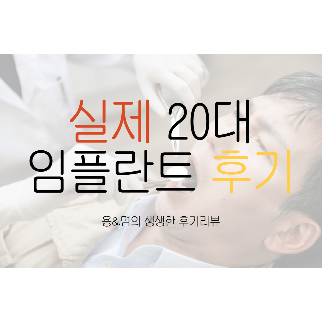  20대 임플란트 후기#2 임플란트 식립, 수술 후 통증은?