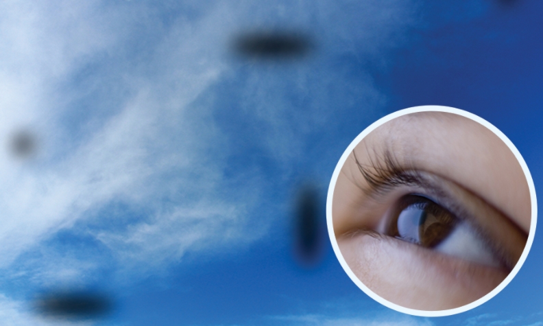 비문증 원인 증상 눈 부유물