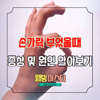  손가락 부었을때 증상 및 원인 빠르게 알아보기