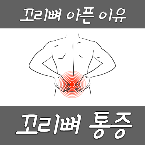 꼬리뼈 통증의 원인 예방법 척추 건강 지키기! 7