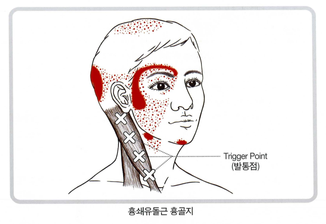 버섯목