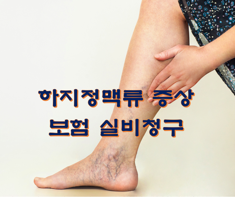  하지정맥류 증상 보험 실비청구