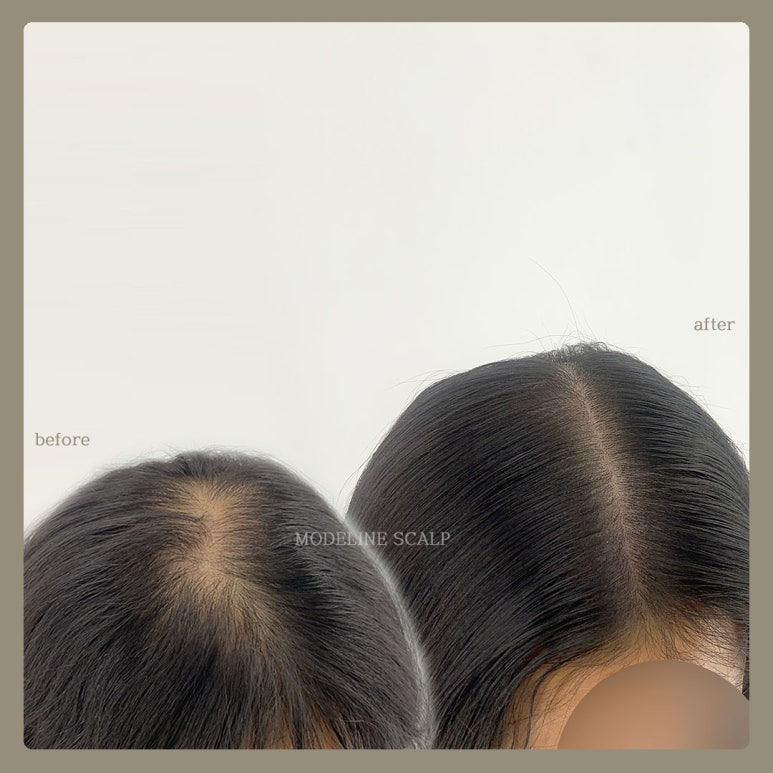 가르마 이미지