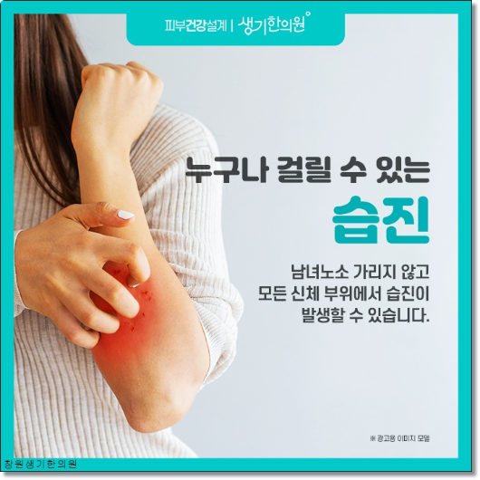 마산습진 치료의 비결은 안정적인 생활습관을 유지하는 것입니다. 5