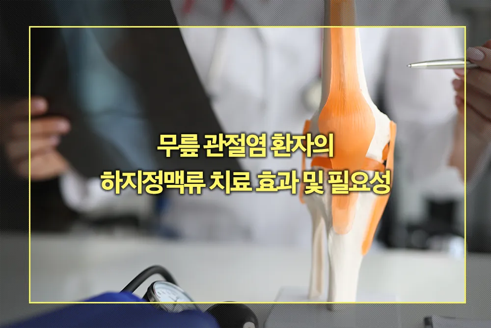 무릎 관절염 환자의 하지정맥류 치료 효과