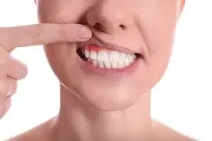 치아