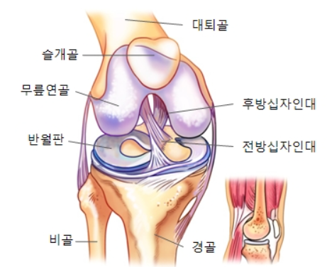  십자인대 파열 증상/원인/수술 후 회복기간