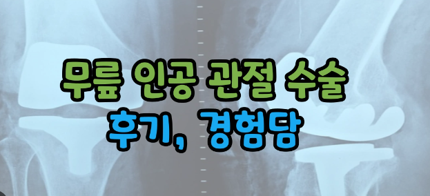 무릎 인공관절 수술