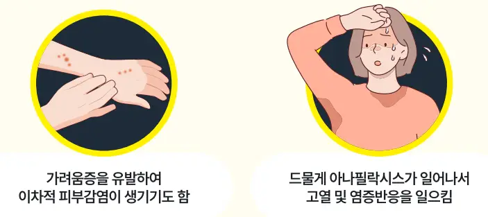 빈대-퇴치법