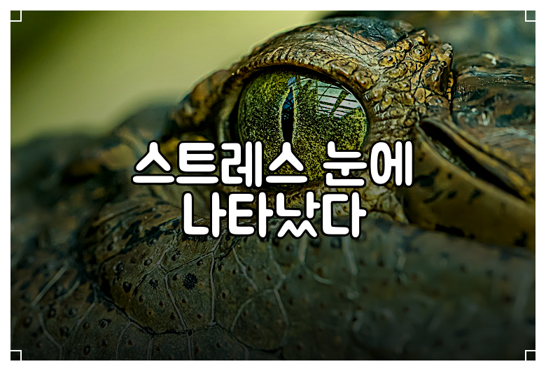 스트레스 눈에 나타났다