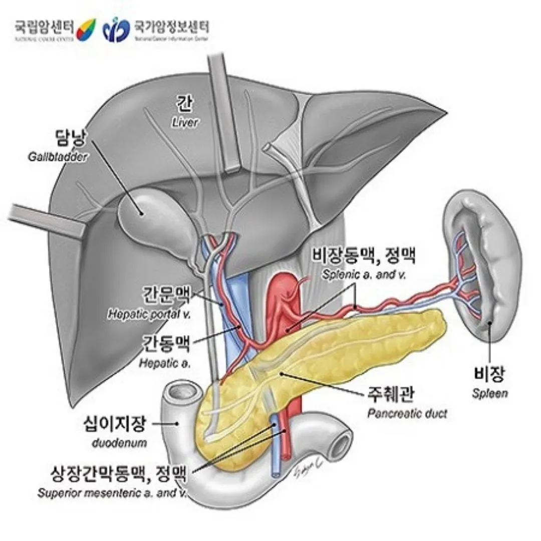 췌장암 초기증상 및 췌장암 원인