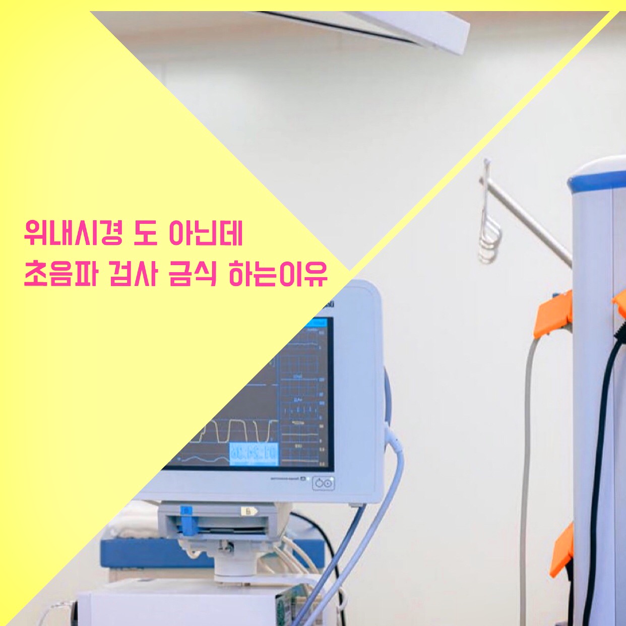  위내시경 도 아닌데 초음파 검사 금식 하는이유