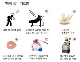 심근경색 초기증상