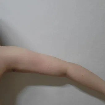 쥬비컷 팔뚝 슬리밍 랩핑 효과 직접 사용 후기와 방법 가격 분석_10